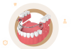 Comprehensive Guide to Dentures in Flint, MI